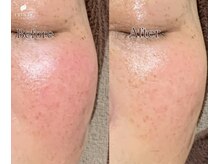 トリンテ バイ フェース(TRINTE by FAITH)の雰囲気（プラチナムフルコースでたるみ毛穴ケア、肌質改善赤み鎮静効果も）