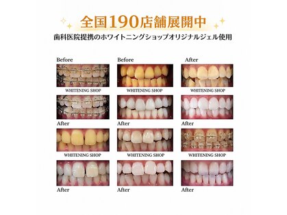 ホワイトニングショップ 町田店の写真