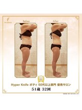 リンカ(Rinka.)/☆帯広初!!ハイパーナイフ導入☆