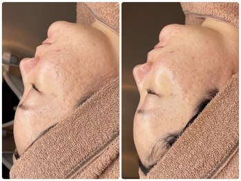 ムゥ(Mwoo)/ララピール/ララピール西宮