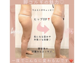 ダリア(Dahlia)/脚コルギ