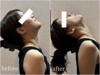 ベレミアム(Bellemium)/辛い首・肩にはネックケア