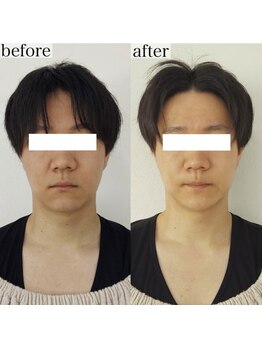 ヴェルシック(Belchic)/男性も凛々しい輪郭へ