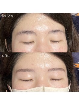 アイリー(IRIE)/ハリウッドブロウリフト