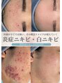 リメイククリニカルビューティー(Remake clinical beauty)&nbsp;肌悩み最短 改善希望