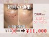 【即実感】全顔光フォト×集中シミケア¥13,000→¥11,000