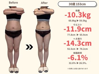 ニドム/30歳　-10kg産後痩身ダイエット1