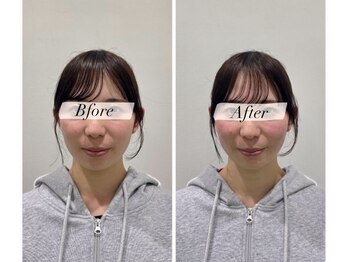 ノモコツ鍼灸 整骨院 赤羽スズラン通り院(NOMOKOTSU鍼灸 整骨院)