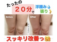 カルマーアンドビー(Calmer & Be.)/【レディース痩身】Before/After