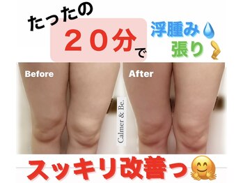 カルマーアンドビー(Calmer & Be.)/【レディース痩身】Before/After