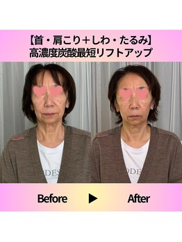 ミサ/フェイシャルエステ