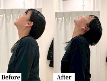 ソレア(Solea)/首こり改善1回目