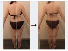 ドクターエイジレス(DR.AGELESS)/筋膜美容整体コース1回