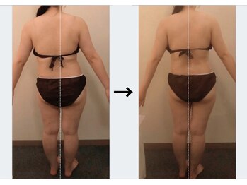 ドクターエイジレス(DR.AGELESS)/筋膜美容整体コース1回