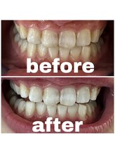 ルナ(LUNA)/20代女性初回お試し