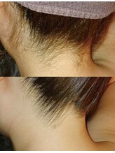 アネル 豊見城(anel)/