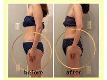 ヨサパーク コクリ(YOSA PARK kokuRi)/痩身/ダイエット/リンパ/産後