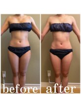 ディス イズ ミー エステティック(This is Me Aesthetic)/本気DEダイエット90分