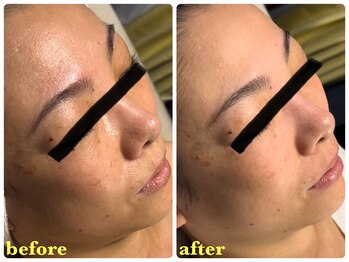 ベルドア(Bell Door)/くすみ肌が気になる方へ