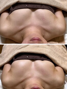 ラディス(Radice.)の写真/【バストアップ専門店】理想のバストを諦めていた方も絶対満足の結果へ導く名古屋屈指のバストアップ店！