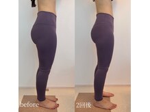 ベレミアム(Bellemium)/骨盤ケアで下半身痩せ