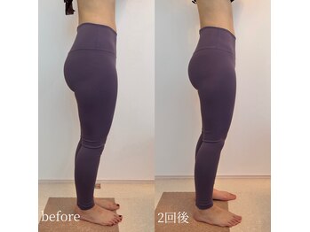 ベレミアム(Bellemium)/骨盤ケアで下半身痩せ