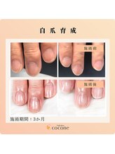 ココネ(cocone)/自爪育成