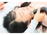 【同クーポン２回目～】美容鍼トータル70分9,300円⇒8,800円