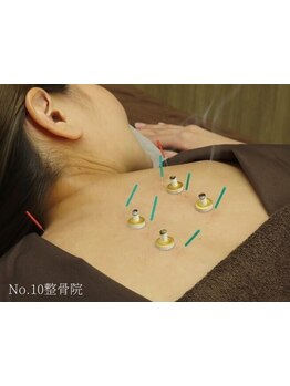 鍼灸施術を受けたい