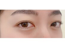 ビート(BEAT)/マツパ