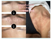 ミロク(369)の雰囲気（大人気！15分間でできるだけ気になる箇所に照射します。）