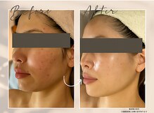 肌イズム 守谷店(肌ism)