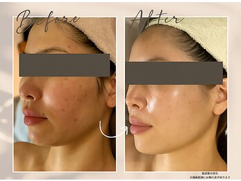 肌イズム 守谷店(肌ism)