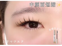 プライベートサロン ヴェール(Veil)/中顔面短縮