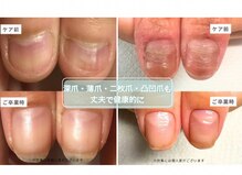 リケアネイル(Re:care nail)