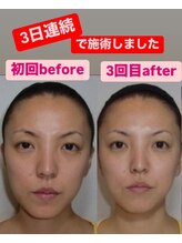 ゆうはり鍼灸整骨院 恵比寿/お客様Before　After