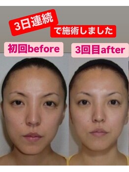 ゆうはり鍼灸整骨院 恵比寿/お客様Before　After
