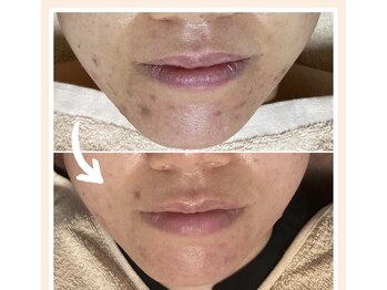 けんこうなかまの施術院 じけ店/