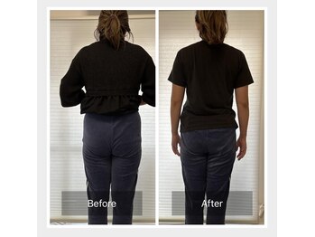 ナオル整体 恵比寿院(NAORU整体)/恵比寿/整体事例【立位姿勢】