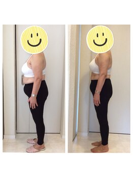 ホロニック ベルサンテ(Holonic Belle Sante)/メディセルハイブリッド