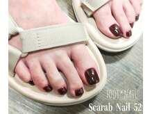 痛みのある巻き爪をUPジェルで改善！！韓国のGNN共同研究開発◎