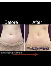 リリーマリア(Lily Maria)/曲線美シルエット