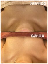 タイカ(Taika)/マシュマロ級ふわもちバスト☆