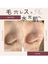 シリウス(Sirius)/3つの美容液で洗浄+潤いを