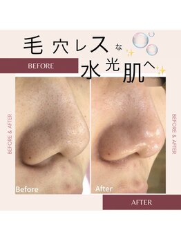 シリウス(Sirius)/3つの美容液で洗浄+潤いを