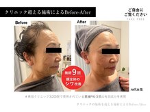 アールーム(Room)/