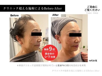 アールーム(Room)/