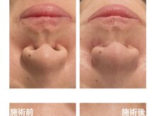 チェンジ(Change)/