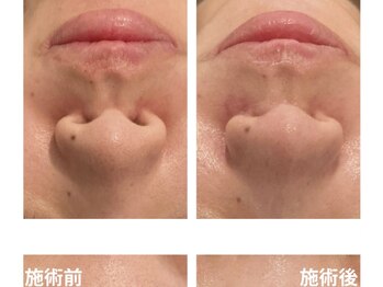 チェンジ(Change)/