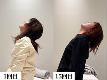 ソレア(Solea)/首こり改善1回目→15回目